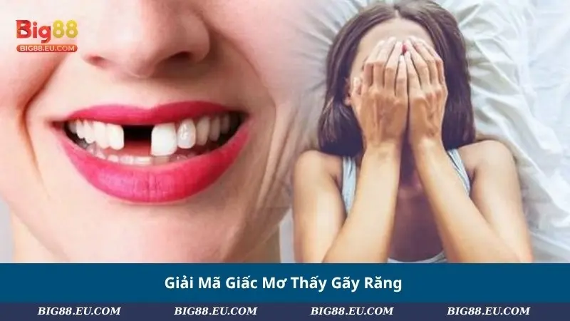 Giải Mã Giấc Mơ Thấy Gãy Răng