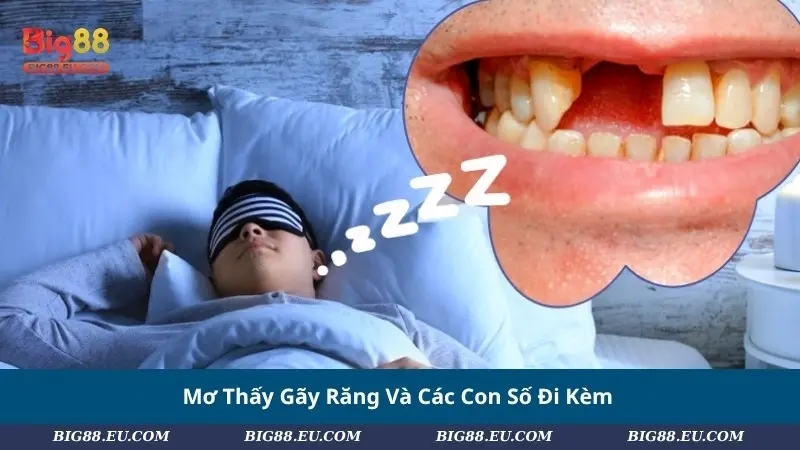 Mơ Thấy Gãy Răng Và Các Con Số May Mắn Đi Kèm